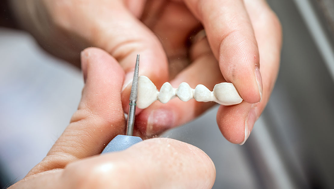 dental implant